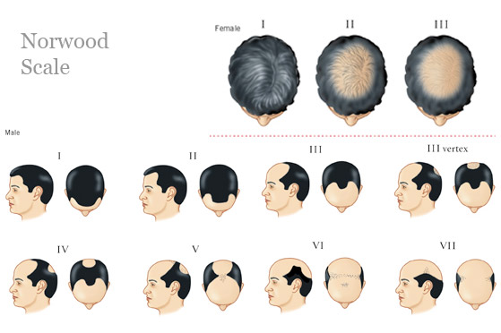 hairpic
